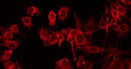 Polyclonal Rabbit anti-Human COT / CROT Antibody (IF, WB)