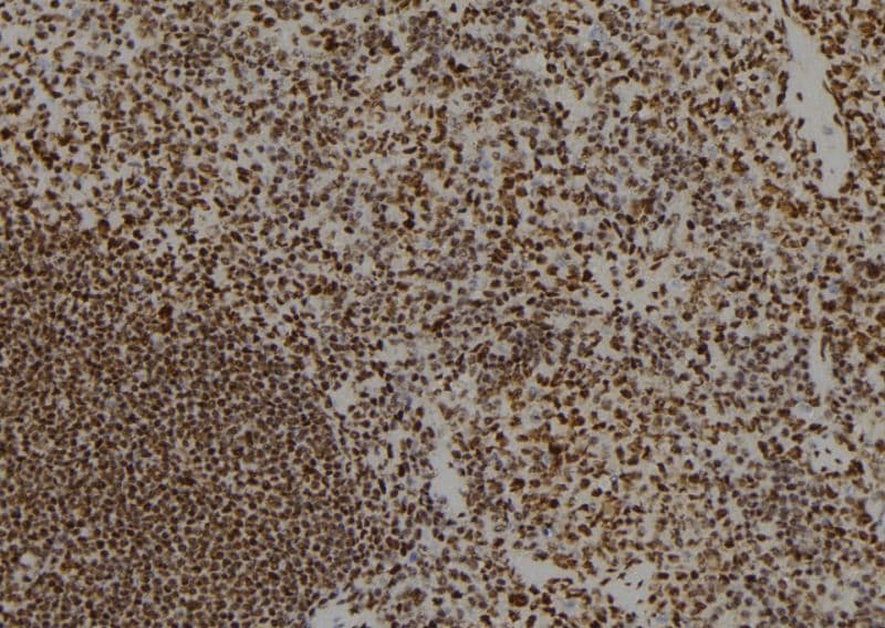 PPM1E Antibody