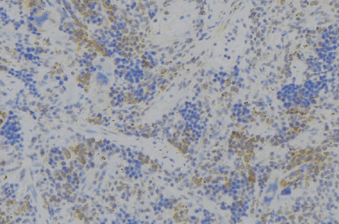 Polyclonal Rabbit anti-Human CD164 Antibody (IHC, WB)