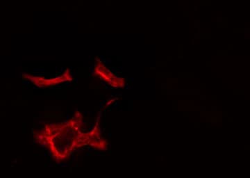 Polyclonal Rabbit anti-Human RAB1B Antibody (IF, WB)