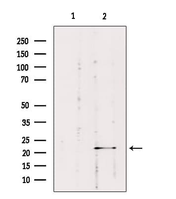 Polyclonal Rabbit anti-Human RAB1B Antibody (IF, WB)