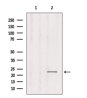 Polyclonal Rabbit anti-Human RAB1B Antibody (IF, WB)