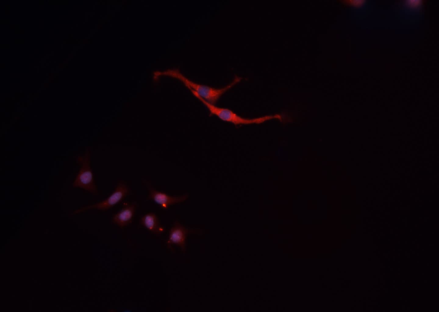 Polyclonal Rabbit anti-Human PIM2 / Pim-2 Antibody (IF, WB)
