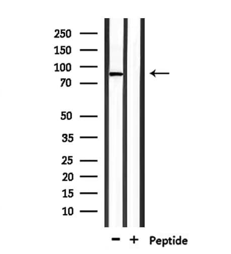 TMC7 Antibody