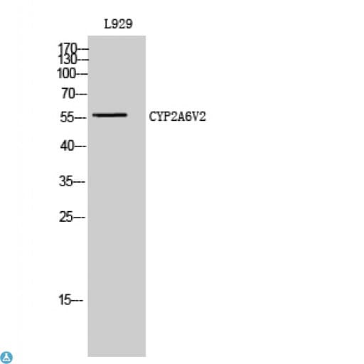 Polyclonal Rabbit anti-Human Cytochrome P450 Antibody (IHC, WB)