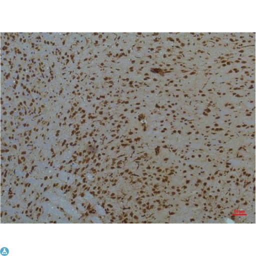 Monoclonal Mouse anti-Human STAT3 Antibody (IHC, WB)