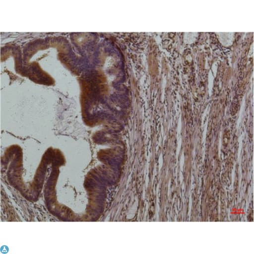 Monoclonal Mouse anti-Human STAT3 Antibody (IHC, WB)