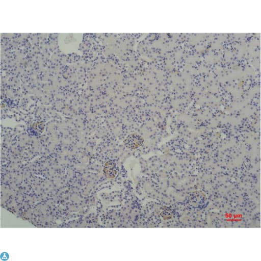 Monoclonal Mouse anti-Human TBP / GTF2D Antibody (IHC)