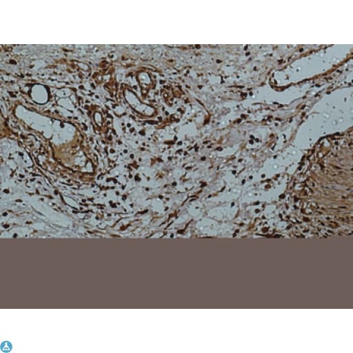 Monoclonal Mouse anti-Human LGALS3 / Galectin 3 Antibody (IHC, WB)