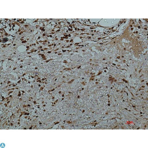 Monoclonal Mouse anti-Human LGALS3 / Galectin 3 Antibody (IHC, WB)