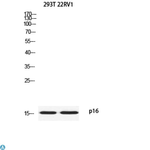 Polyclonal Rabbit anti-Human p16INK4a / CDKN2A Antibody (WB)