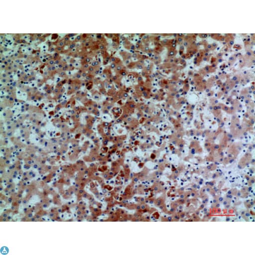 Polyclonal Rabbit anti-Human Complement C7 Antibody (IHC, WB)