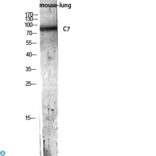 Polyclonal Rabbit anti-Human Complement C7 Antibody (IHC, WB)