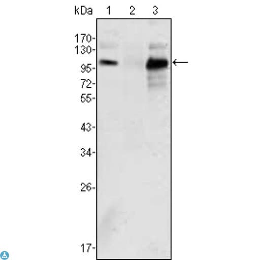 Monoclonal Mouse anti-Human AR / Androgen Receptor Antibody (IHC, WB)