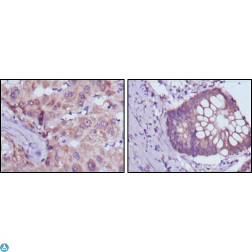 Monoclonal Mouse anti-Human SDR9C1 / BDH1 Antibody (IHC, WB)