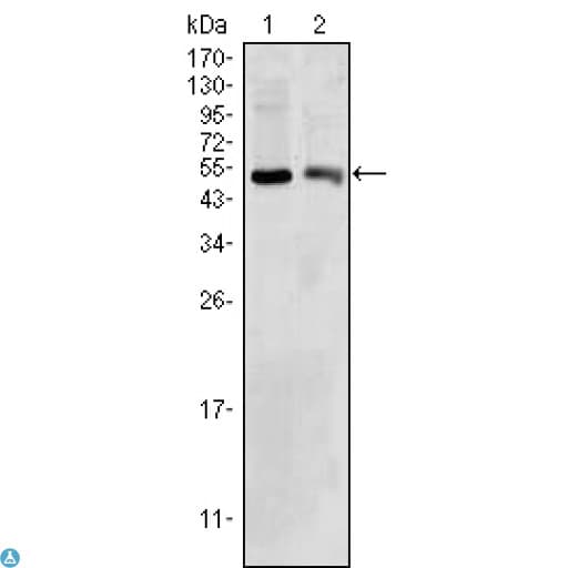 Monoclonal Mouse anti-Human SDR9C1 / BDH1 Antibody (IHC, WB)
