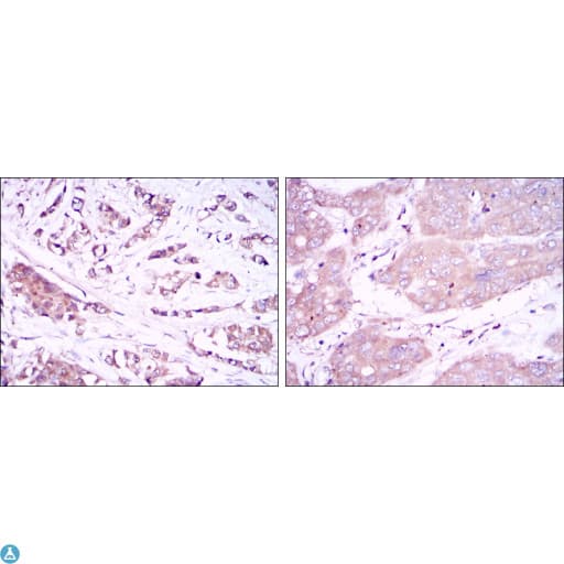 Monoclonal Mouse anti-Human BECN1 / Beclin-1 Antibody (IHC, WB)