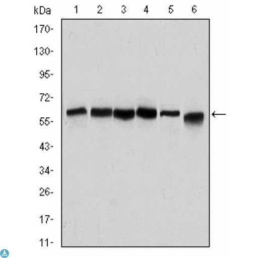 Monoclonal Mouse anti-Human BECN1 / Beclin-1 Antibody (IHC, WB)