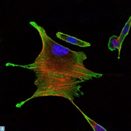 Monoclonal Mouse anti-Human BMPR2 Antibody (IHC, IF, WB)