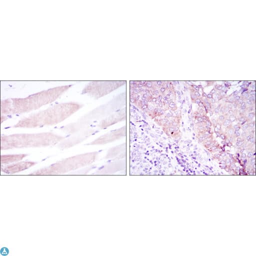 Monoclonal Mouse anti-Human BMPR2 Antibody (IHC, IF, WB)