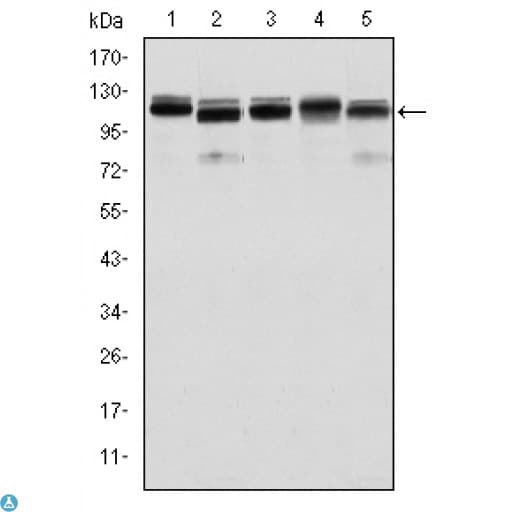 Monoclonal Mouse anti-Human BMPR2 Antibody (IHC, IF, WB)