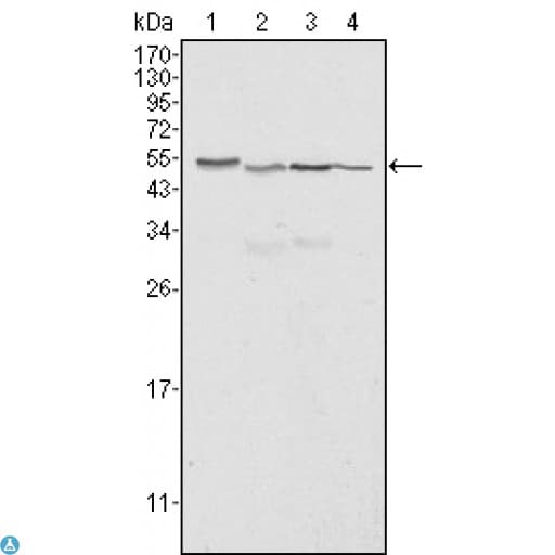 Monoclonal Mouse anti-Human CALR / Calreticulin Antibody (IHC, IF, WB)