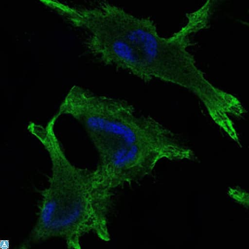 Monoclonal Mouse anti-Human JUP/CTNNG/Junction Plakoglobin Antibody (IHC, IF, WB)