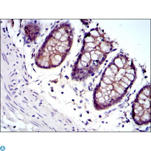 Monoclonal Mouse anti-Human JUP/CTNNG/Junction Plakoglobin Antibody (IHC, IF, WB)