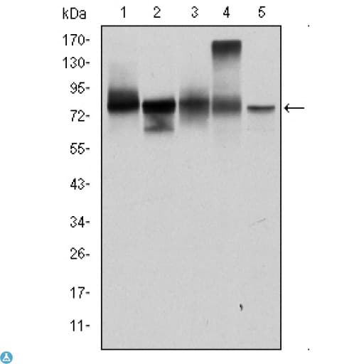 Monoclonal Mouse anti-Human JUP/CTNNG/Junction Plakoglobin Antibody (IHC, IF, WB)