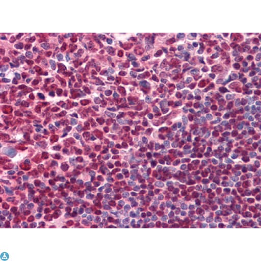 Monoclonal Mouse anti-Human CD20 Antibody (IHC, IF)