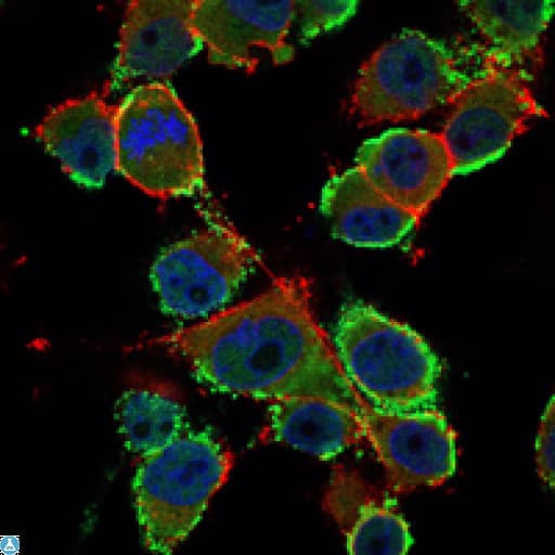 Monoclonal Mouse anti-Human CEACAM5 / CD66e Antibody (IF, WB)