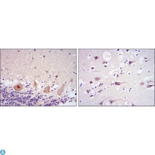 Monoclonal Mouse anti-Human CDK5 Antibody (IHC, IF, WB)