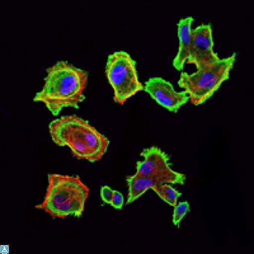 Monoclonal Mouse anti-Human CDK5 Antibody (IHC, IF, WB)
