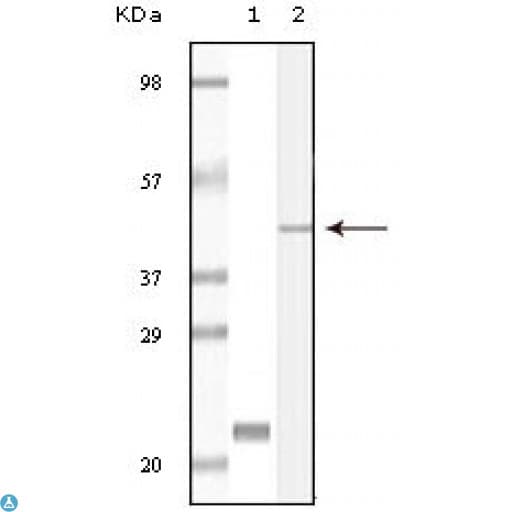 Monoclonal Mouse anti-Human CIB1 / KIP Antibody (IHC, WB)