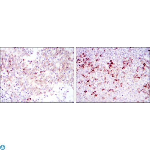 Monoclonal Mouse anti-Human CTTN / Cortactin Antibody (IHC, WB)