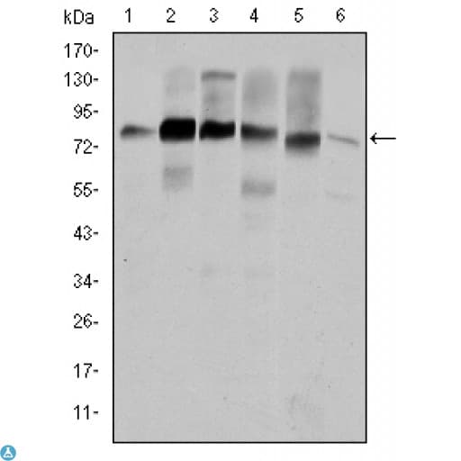 Monoclonal Mouse anti-Human CTTN / Cortactin Antibody (IHC, WB)