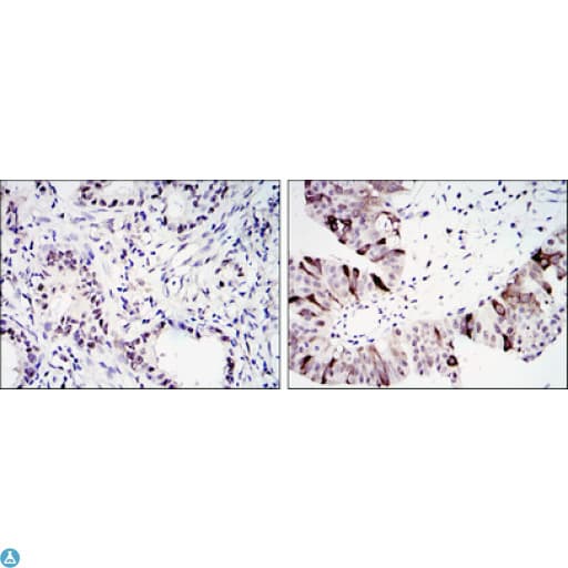 Monoclonal Mouse anti-Human CCNB1 / Cyclin B1 Antibody (IHC, WB)