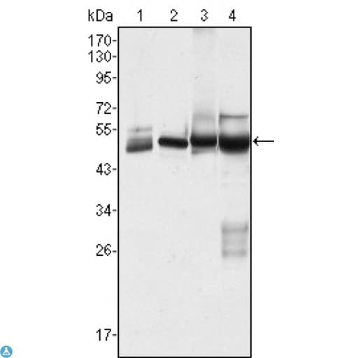 Monoclonal Mouse anti-Human KRT7 / CK7 / Cytokeratin 7 Antibody (WB)