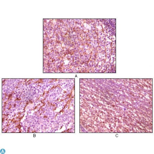 Monoclonal Mouse anti-Human DNM1 / Dynamin Antibody (IHC, WB)