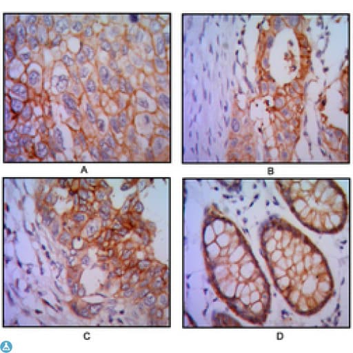 Monoclonal Mouse anti-Human EPCAM Antibody (IHC, WB)