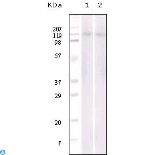 Monoclonal Mouse anti-Human EPHB6 / EPH Receptor B6 Antibody (IHC, WB)