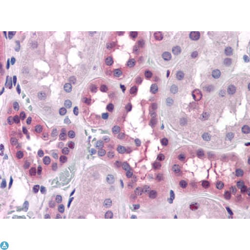 Monoclonal Mouse anti-Human ERK1 + ERK2 Antibody (IHC, WB)