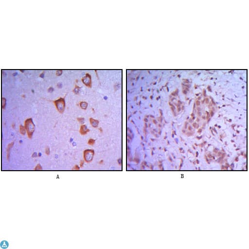 Monoclonal Mouse anti-Human ETS1 / ETS-1 Antibody (IHC, WB)