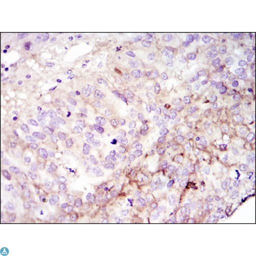 Monoclonal Mouse anti-Human FAK / Focal Adhesion Kinase Antibody (IHC, IF, WB)