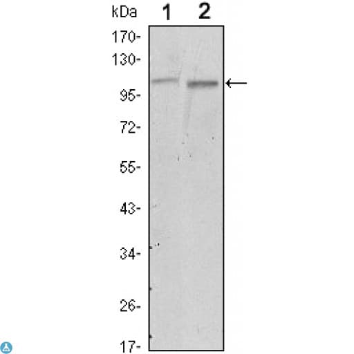 Monoclonal Mouse anti-Human FAK / Focal Adhesion Kinase Antibody (IHC, IF, WB)