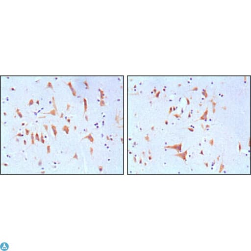 Monoclonal Mouse anti-Human FMR1 / FMRP Antibody (IHC, IF, WB)