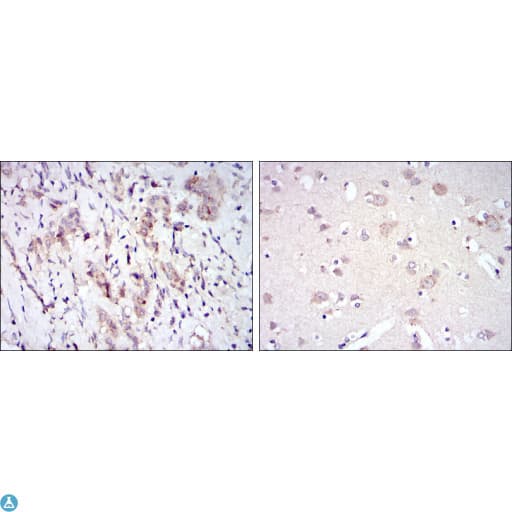 Monoclonal Mouse anti-Human SYN / FYN Antibody (IHC, IF, WB)