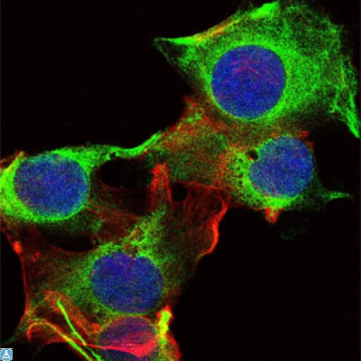 Monoclonal Mouse anti-Human SYN / FYN Antibody (IHC, IF, WB)