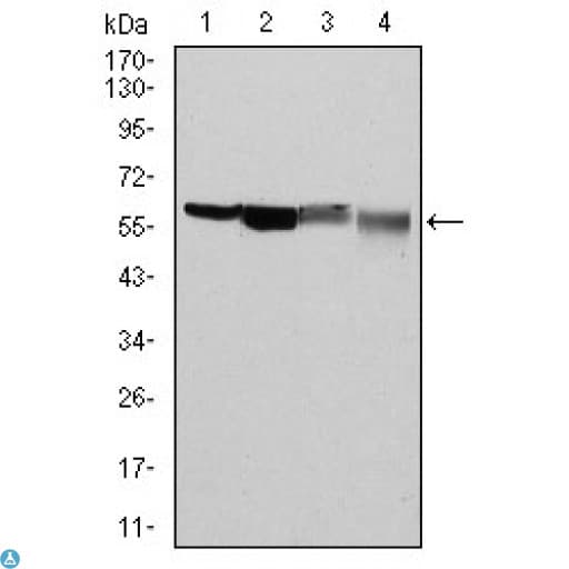 Monoclonal Mouse anti-Human G6PD Antibody (IHC, WB)