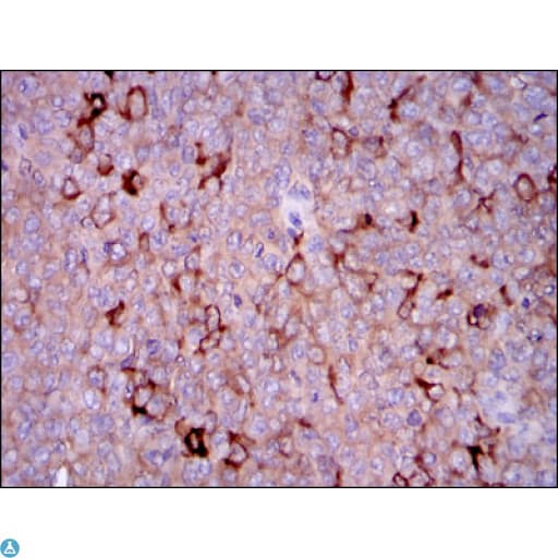 Monoclonal Mouse anti-Human G6PD Antibody (IHC, WB)